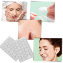 36-Pack Invisible Acne Patches