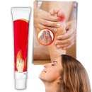 Anti-inflammatory Bunion Cream