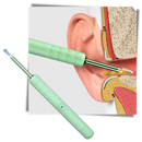 Intelligent Ear Cleaner Stick