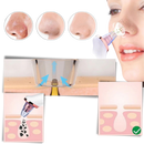 Blackhead Pore Remover Vacuum