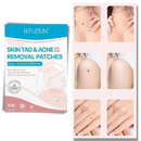 Skin tag removal treatment patch