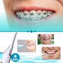 Air Powered Teeth Water Flosser
