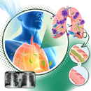 Breath Ease Natural Spray