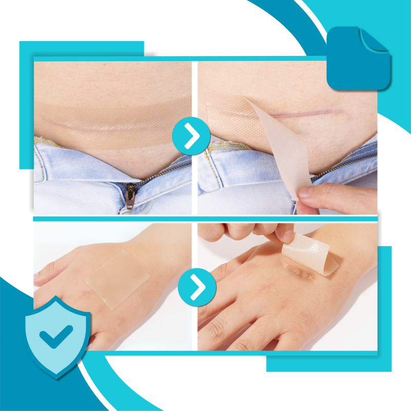 Hyaluronic Silicone Scar Patch