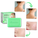 Moisturizing Exfoliator Wart Removal Soap