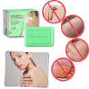 Moisturizing Exfoliator Wart Removal Soap