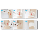 Water-proof wound adhesive