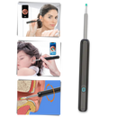 Smart Ear Wax Removal Camera
