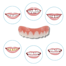 Snap-On Veneer Teeth