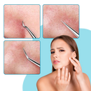 Ultra Precision Pointed Tweezers